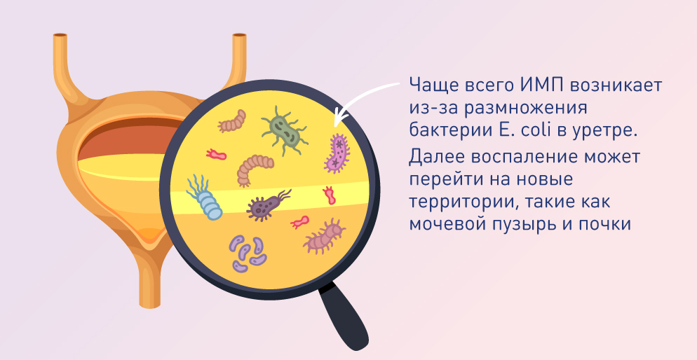 Боль при мочеиспускании у женщин-02.jpg